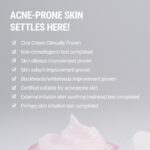 ROVECTIN - Cica Care Cream – Cremă Calmanta Anti-acnee pentru Față (50 ml) - imagine 4